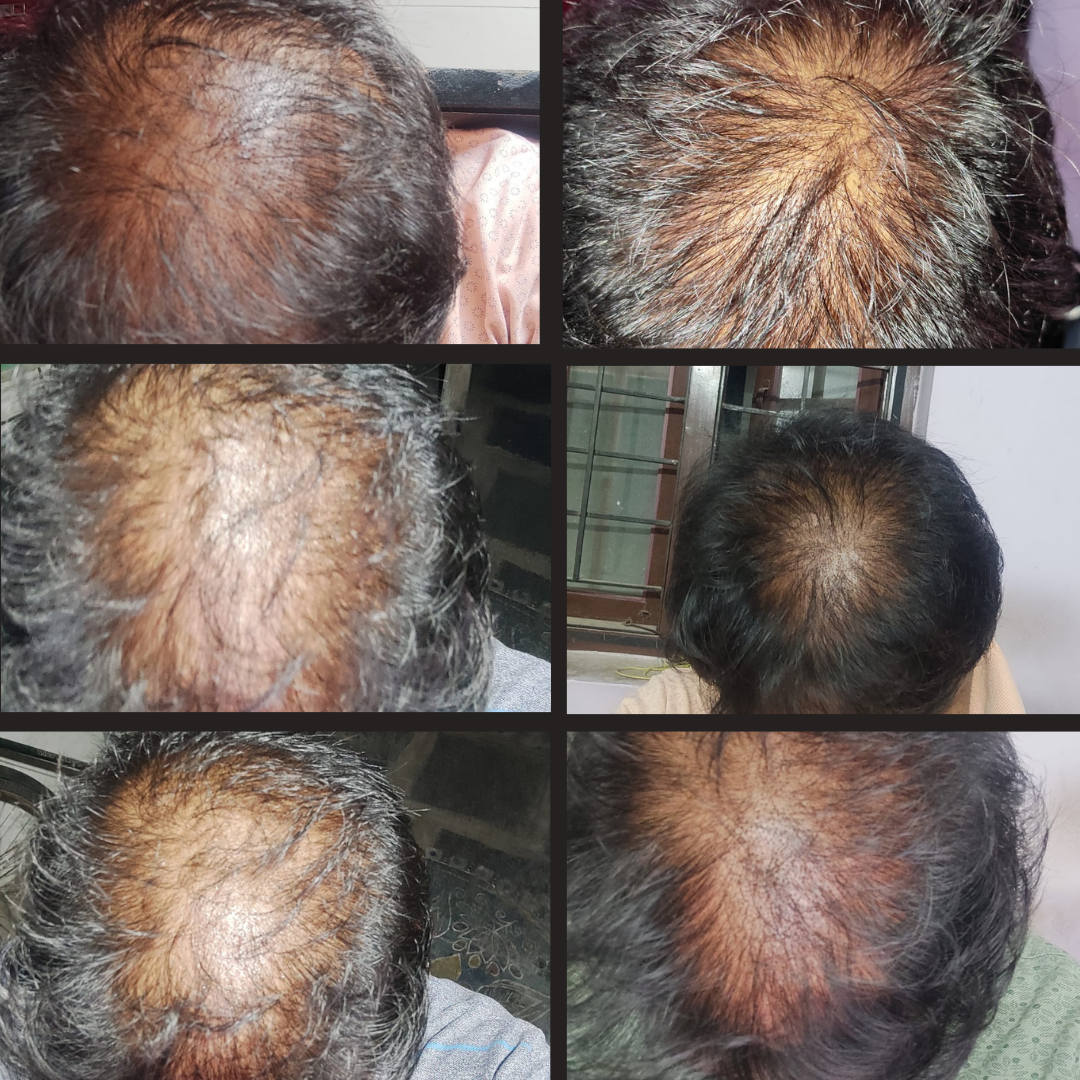 Green and Brown Before and After Hairstyle YouTube Thumbnail (1)