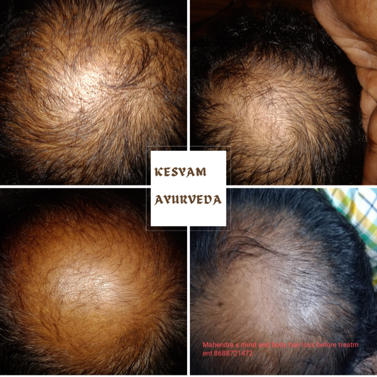 Kesyam Ayurveda (1)